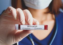 コロナウィルスによる非対面化の躍進